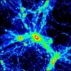 Felfúvódó Univerzum + sötét anyag kontra húrelmélet